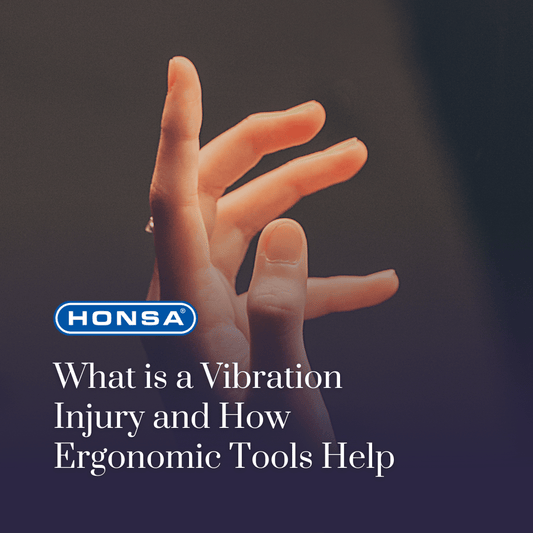 An image of a hand, which can be affected by vibration injury